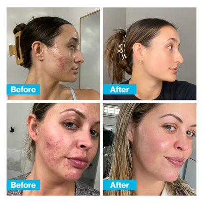 [ONE-TIME OFFER] Buy One, Get TWO FREE